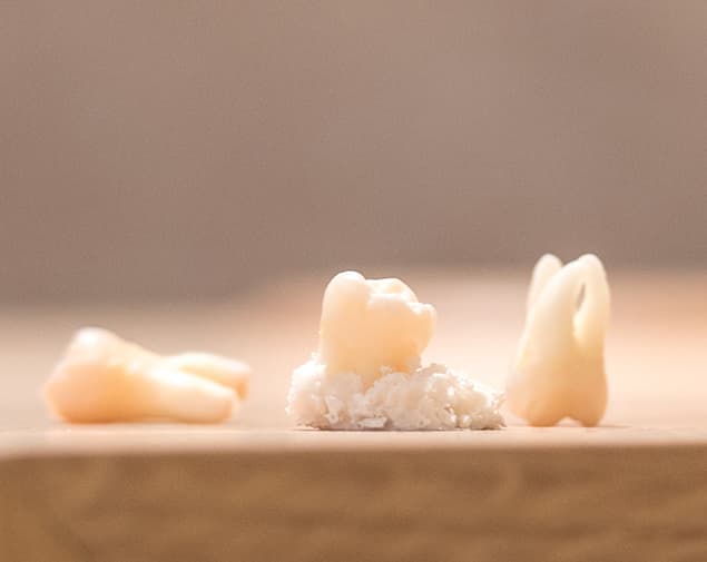 knochenaufbauende_massnahmen_rk1_6437_small_sq