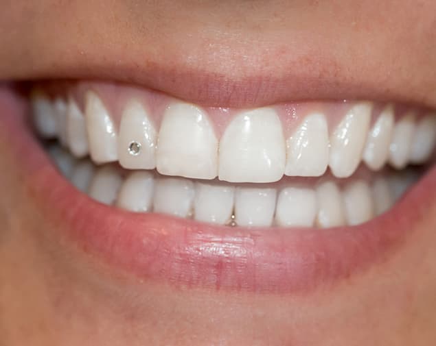 parodontosebehandlung-860-small_sq