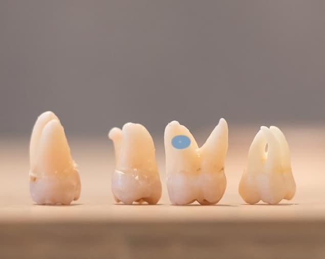 wurzelspitzenresektionen_rk1_6402a_small_sq